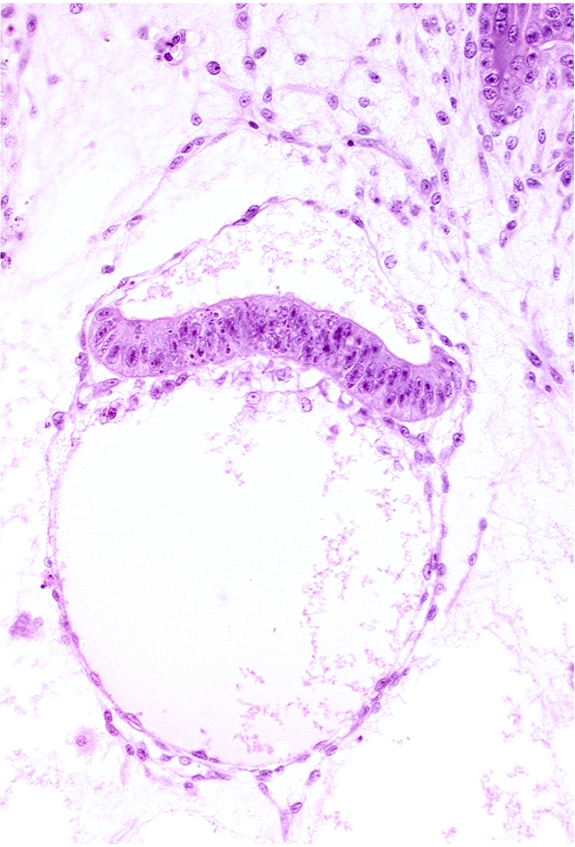 amniotic cavity, extra-embryonic coelom, head mesenchyme, hypoblast, mesoblast (mesenchyme), two-layered amnion