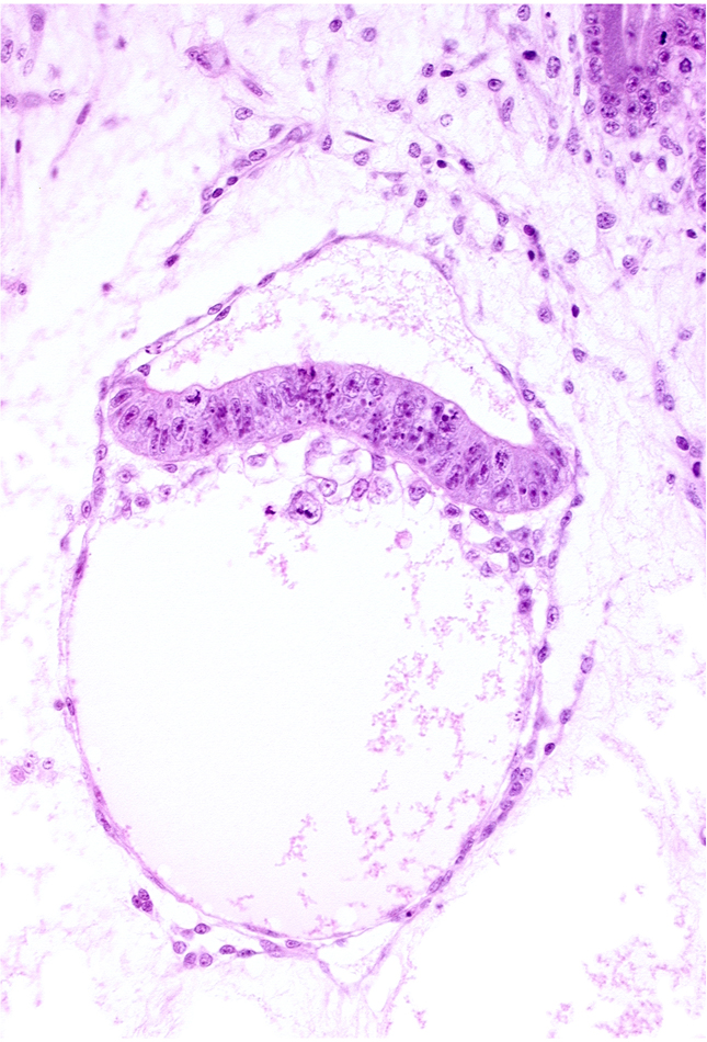 amnion, amniotic cavity, hypoblast, two-layered secondary umbilical vesicle wall