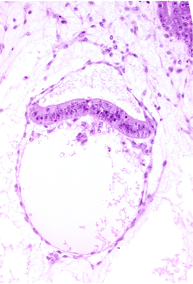 amnion, clump of cells in hypoblast, extra-embryonic coelom, intervillus space(s), junction of extra-embryonic endoderm and hypoblast, secondary umbilical vesicle process