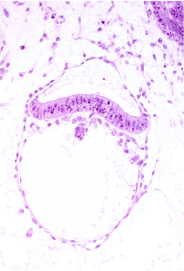 amnion, amniotic cavity, head mesenchyme, secondary umbilical vesicle cavity