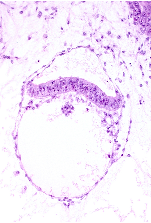 clump of cells in hypoblast, epiblast, extra-embryonic endoderm, head mesenchyme, mesoblast (mesenchyme)