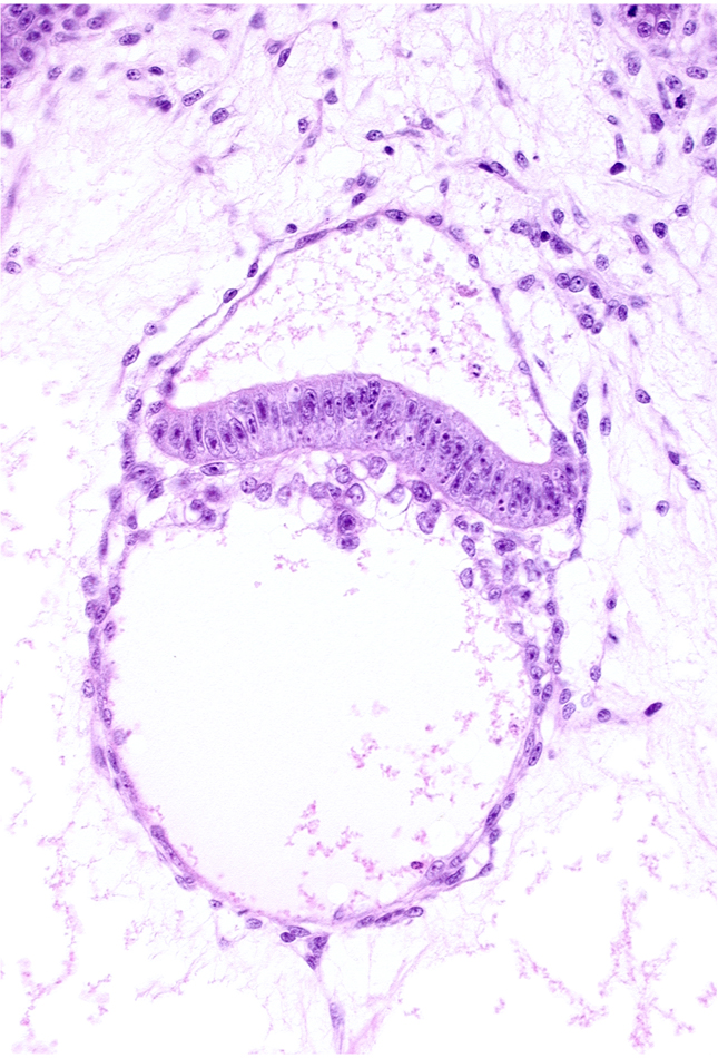 amnion, clump of cells in hypoblast, extra-embryonic endoderm, intervillus space(s)