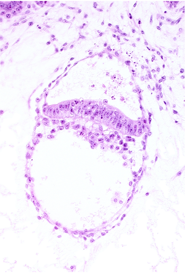 amniotic cavity, extra-embryonic coelom, extra-embryonic endoderm, head mesenchyme, secondary umbilical vesicle cavity