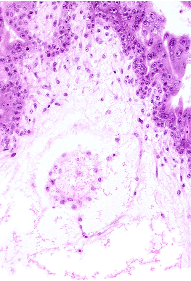 cephalic part of secondary umbilical vesicle wall, extra-embryonic coelom (exocoelom), mesoblast (mesenchyme)