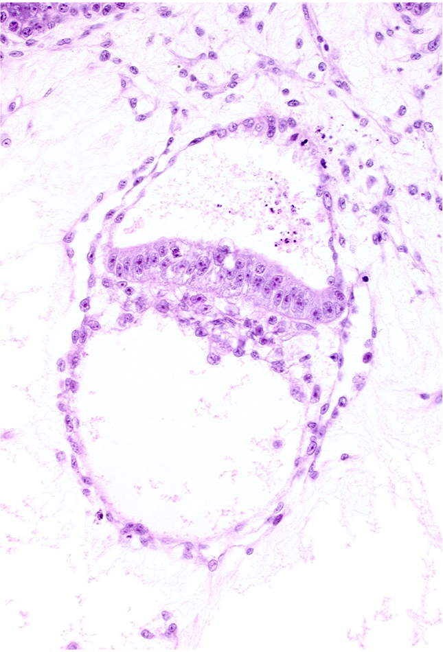 amniotic cavity, epiblast, hypoblast, presumptive prechordal plate, primordial blood vessel(s), secondary umbilical vesicle cavity