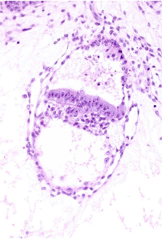amniotic cavity, cephalic edge of presumptive amniotic duct, embryonic endoderm, embryonic mesoderm, epiblast, extra-embryonic endoderm, extra-embryonic mesoblast, presumptive gastrulation (primitive) node, primordial connecting stalk, two-layered amnion