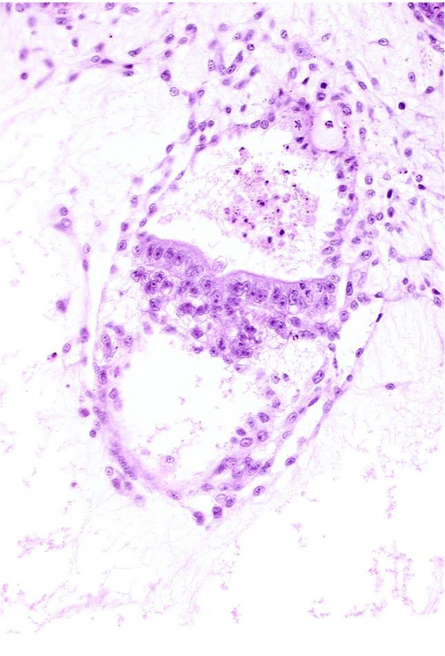 caudal part of secondary umbilical vesicle cavity, cephalic part of primordial gastrulation (primitive) groove, embryonic endoderm, epiblast, extra-embryonic endoderm, intervillus space(s), presumptive amniotic duct, primary villus, site of epitheliomesenchymal transformation, stem villus