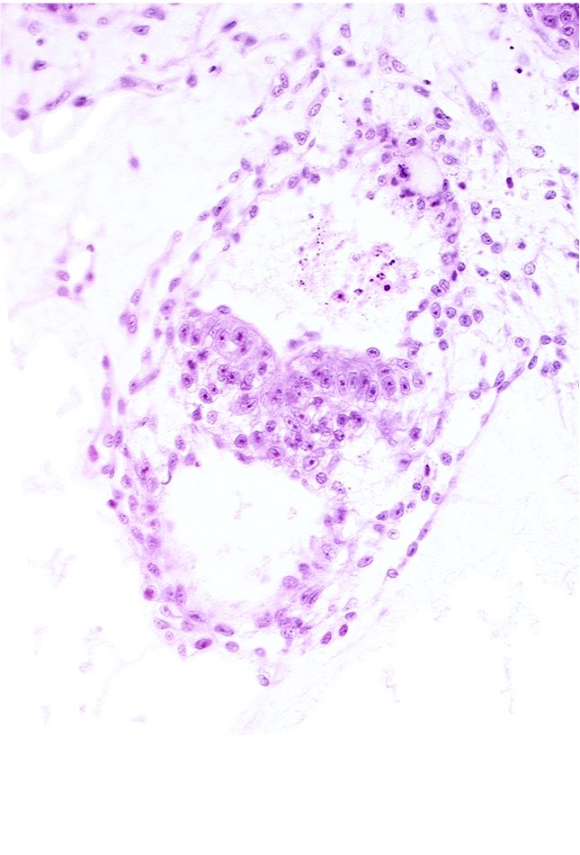 amniotic cavity, caudal end of primordial gastrulation (primitive) streak, extra-embryonic mesoderm (mesenchyme), intervillus space(s), primary villus, primordial connecting stalk, stem villus