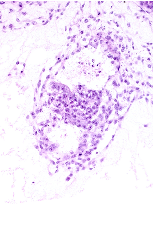 amniotic cavity, caudal edge of presumptive amniotic duct, caudal end of primordial gastrulation (primitive) groove, caudal end of primordial gastrulation (primitive) streak, caudal part of secondary umbilical vesicle cavity, epiblast, mesoderm, presumptive cloacal membrane, primordial germ cell(s)