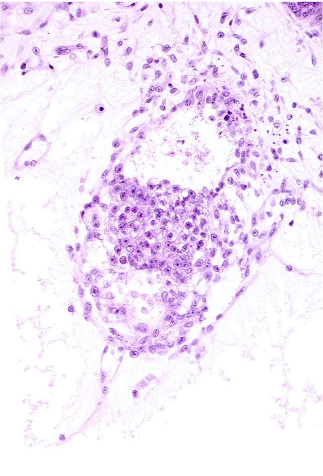 caudal edge of secondary umbilical vesicle cavity, extra-embryonic coelom, presumptive allantoic diverticulum, secondary umbilical vesicle process
