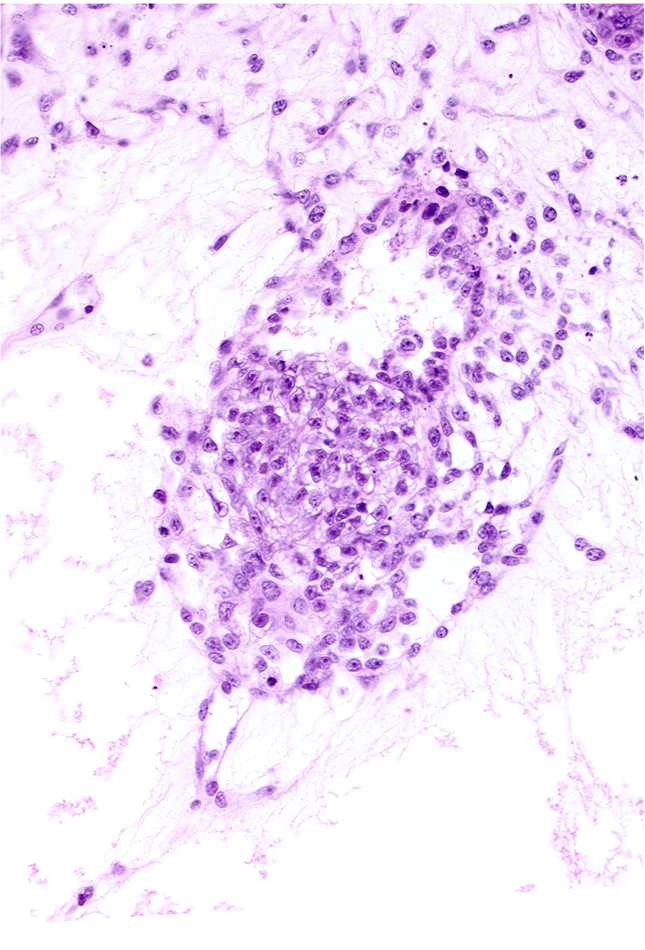 caudal part of amniotic cavity, caudal part of epiblast, endodermal mass, secondary umbilical vesicle process, specialized cells in amnion