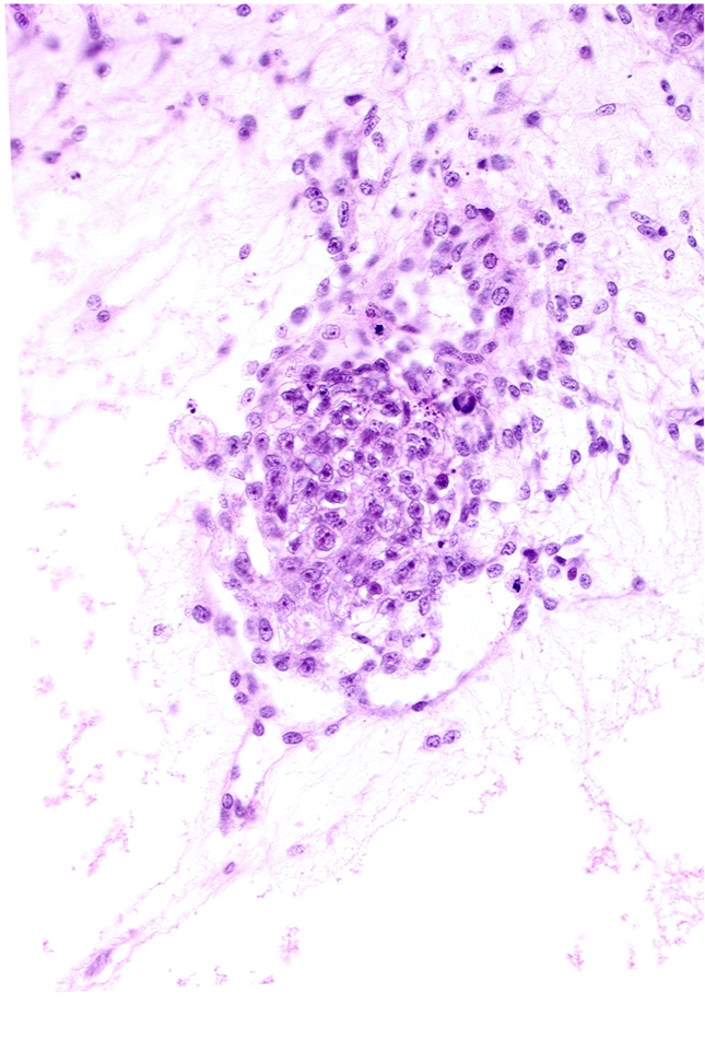 caudal edge of amniotic cavity, extra-embryonic coelom, primordial blood vessel(s)