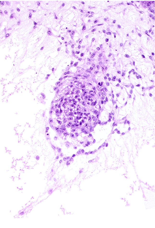 caudal edge of specialized cells in amnion, cytotrophoblast, endodermal mass, intervillus space(s), primordial connecting stalk, primordial germ cell(s), syncytiotrophoblast