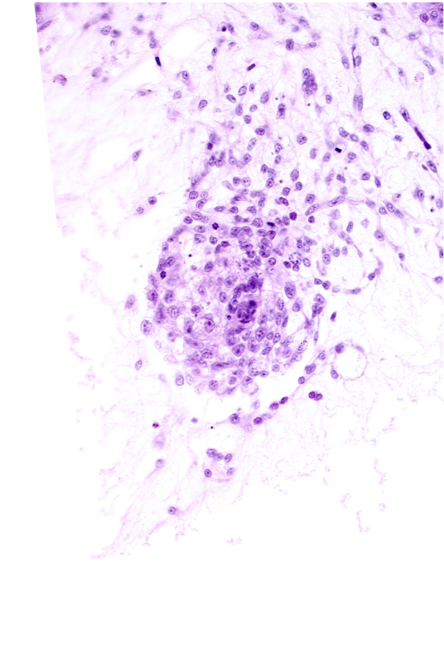 extra-embryonic coelom, primordial blood vessel(s), stem villus, syncytiotrophoblast