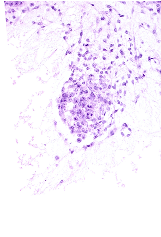 extra-embryonic mesoblast, intervillus space(s), primordial blood vessel(s), syncytiotrophoblast