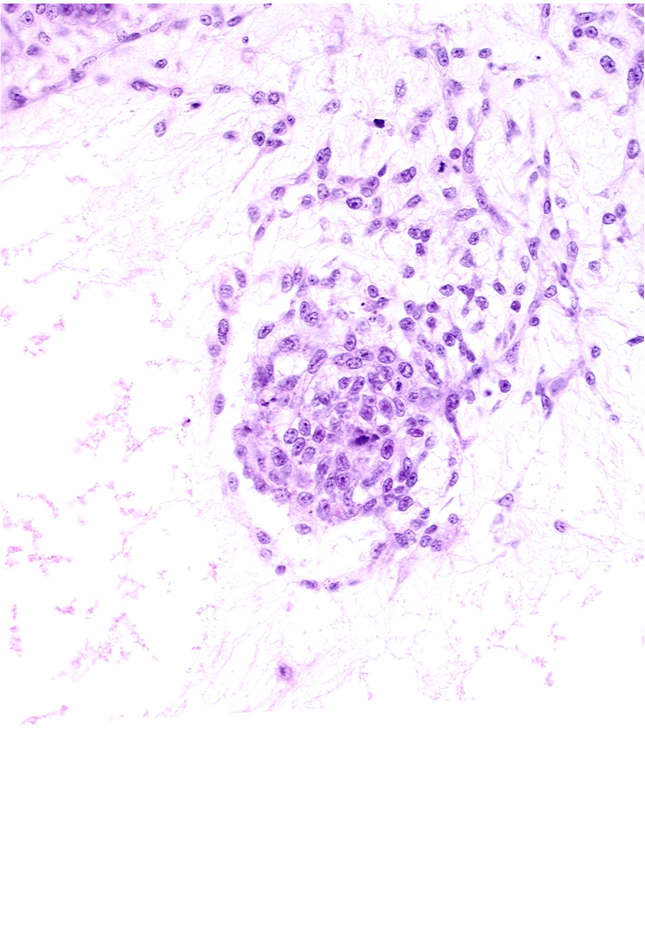 endodermal mass, extra-embryonic mesoblast, hemangioblastic tissue, primordial connecting stalk mesenchyme, stem villus