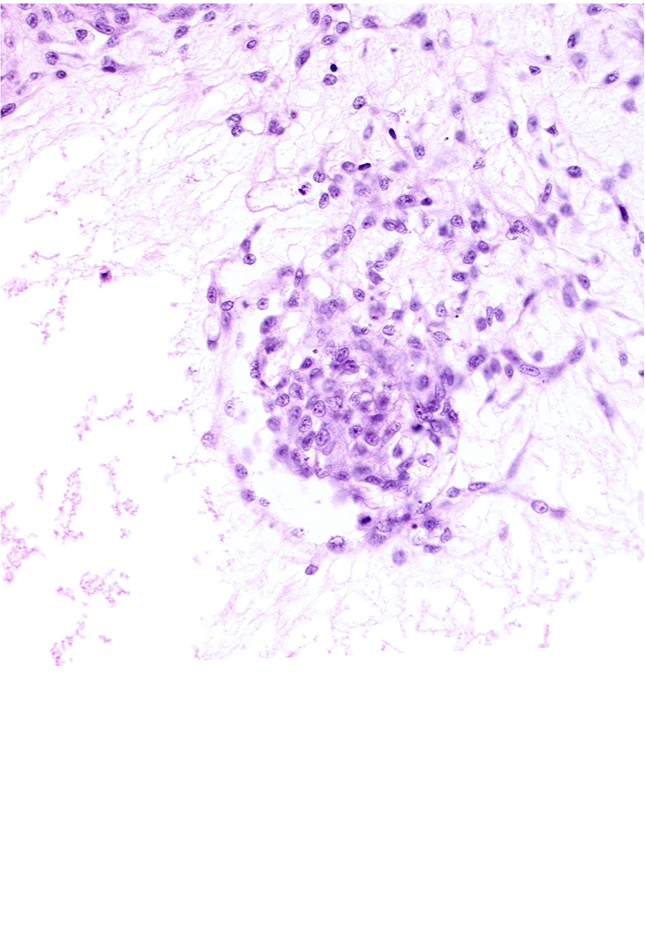 extra-embryonic coelom, extra-embryonic mesoblast, intervillus space(s)