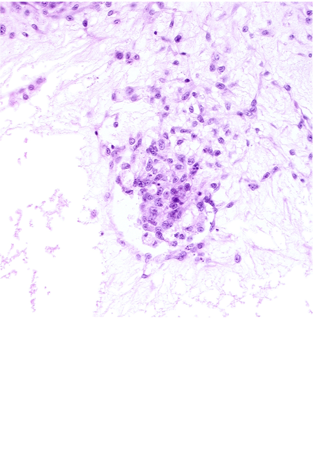 caudal part of endodermal mass, extra-embryonic coelom, extra-embryonic mesoblast, hemangioblastic tissue, mesoblast (mesenchyme) core of secondary stem villus, primordial germ cell(s)