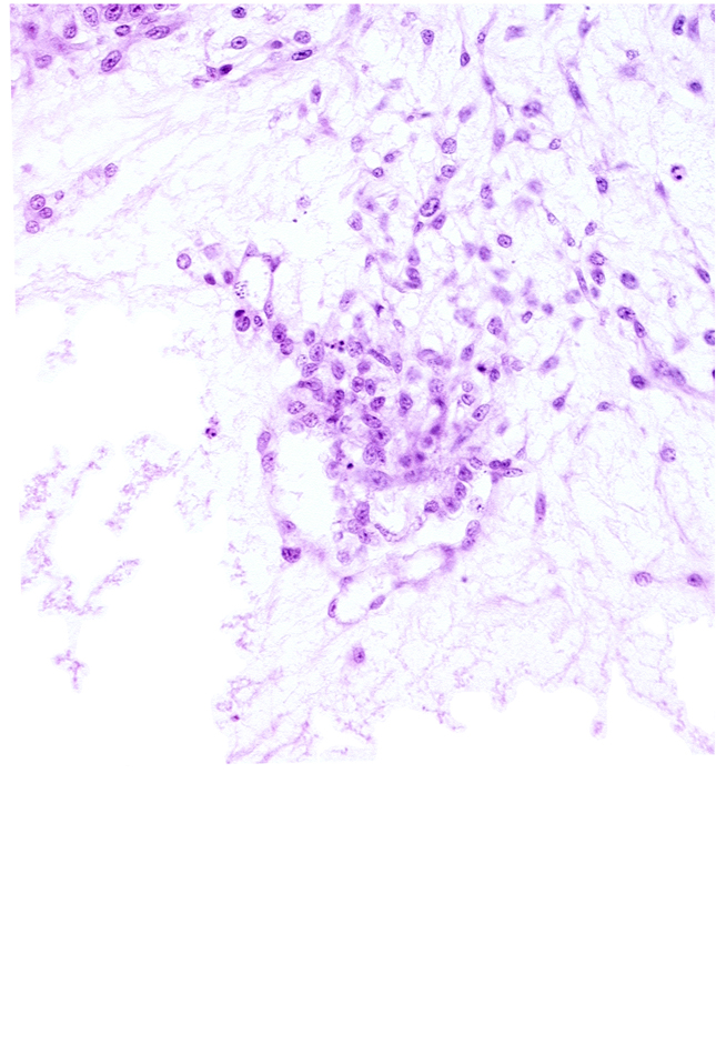 extra-embryonic coelom, syncytiotrophoblast