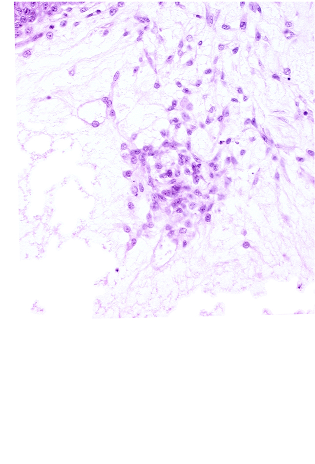 cytotrophoblast, extra-embryonic coelom, primordial germ cell(s)