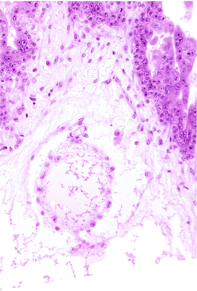 cephalic part of secondary umbilical vesicle wall, extra-embryonic coelom (exocoelom), intervillus space(s), secondary umbilical vesicle wall, trophoblast