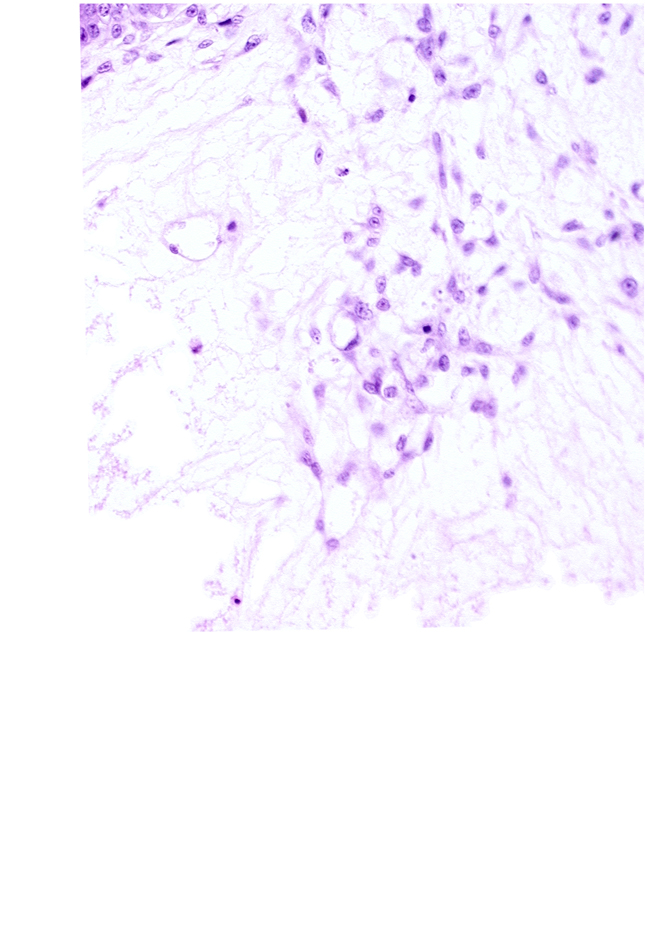 cytotrophoblast, extra-embryonic coelom, mesoblast (mesenchyme) core of secondary stem villus, mesoblast(s) in caudal wall of secondary umbilical vesicle, primordial blood vessel(s), primordial connecting stalk, primordial germ cell(s), syncytiotrophoblast