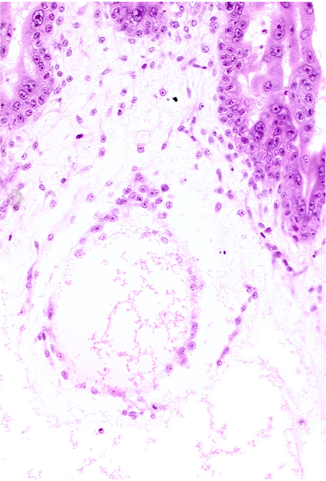 cephalic edge of embryonic disc, extra-embryonic coelom, extra-embryonic somatopleuric mesoderm, mesoblast (mesenchyme), secondary umbilical vesicle cavity, secondary umbilical vesicle wall, stem villus