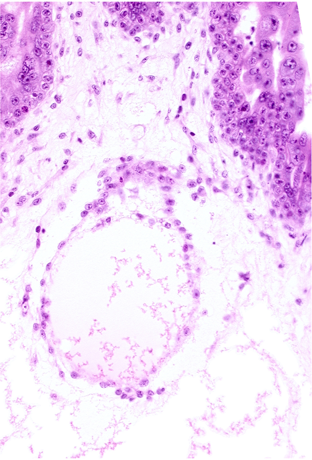 extra-embryonic coelom, extra-embryonic splanchnopleuric mesoderm, stem villus