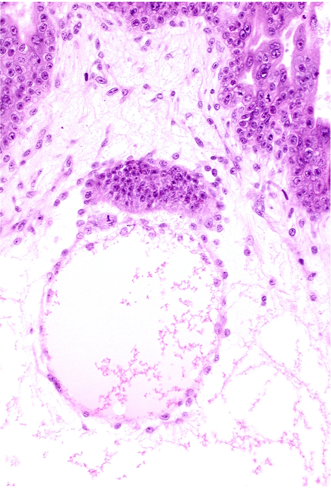 extra-embryonic coelom, intervillus space(s), secondary villus