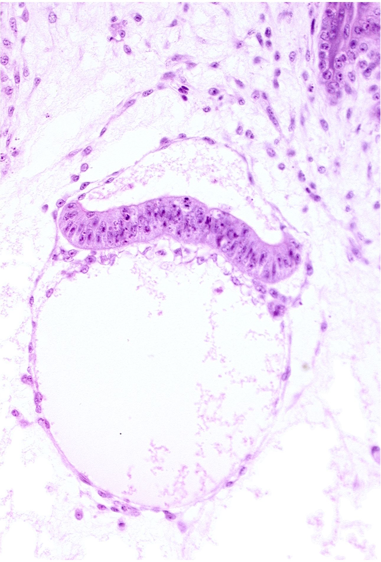 amnion, extra-embryonic coelom, intervillus space(s), secondary umbilical vesicle cavity