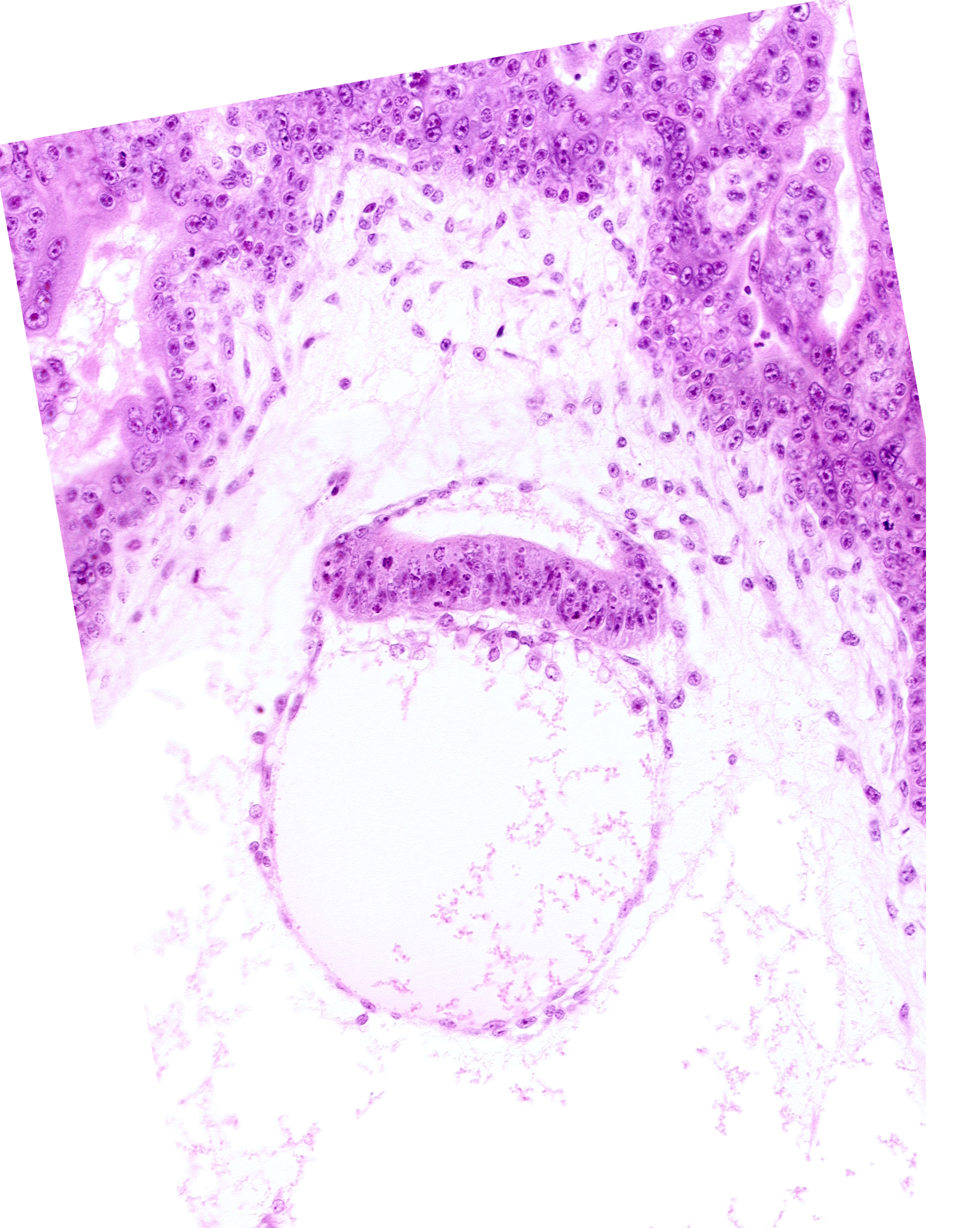 embryonic disc, epiblast, extra-embryonic coelom, head mesenchyme, hypoblast, secondary umbilical vesicle cavity