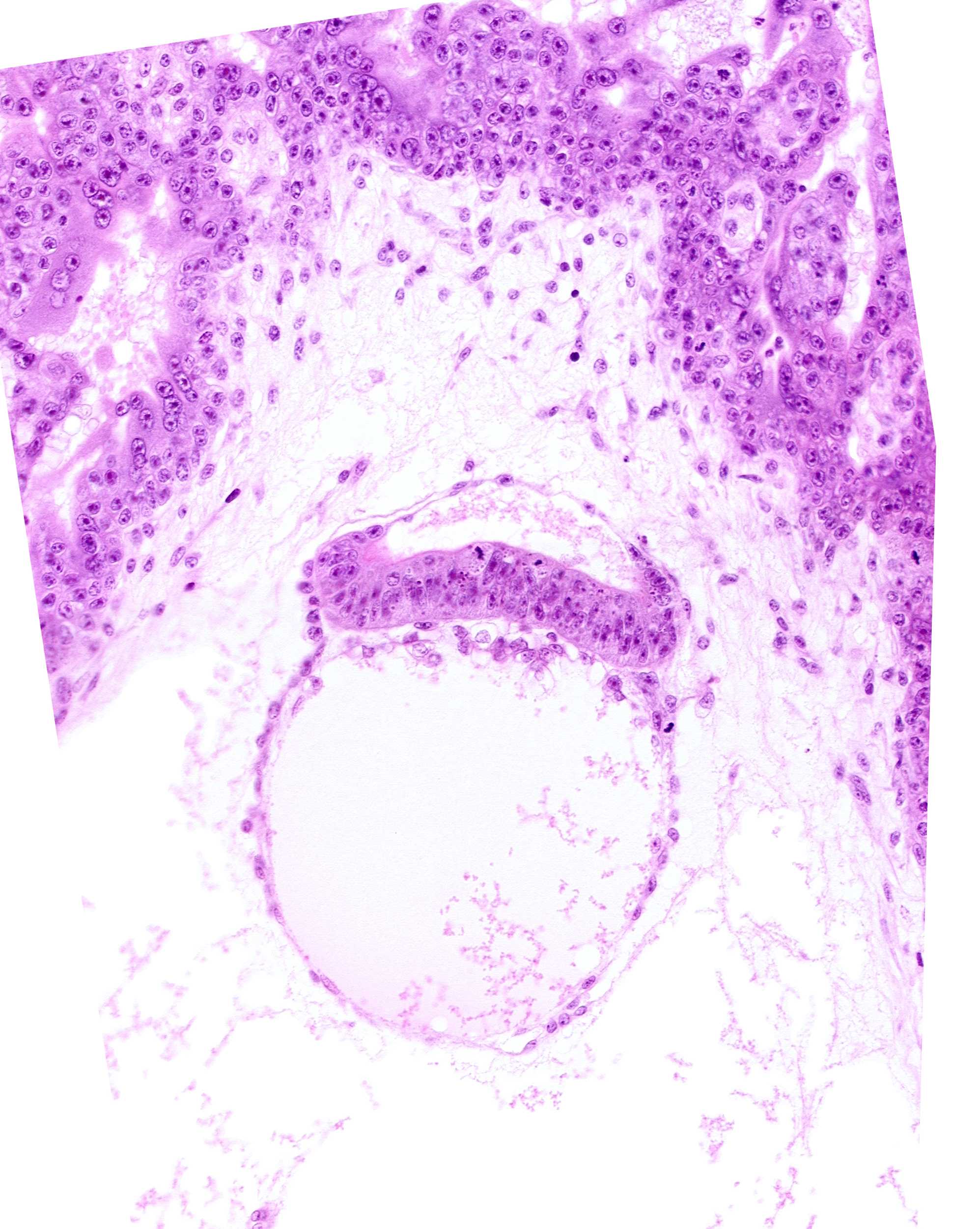 amniotic cavity, epiblast, head mesenchyme, hypoblast, one-layered surface epithelium, secondary umbilical vesicle cavity