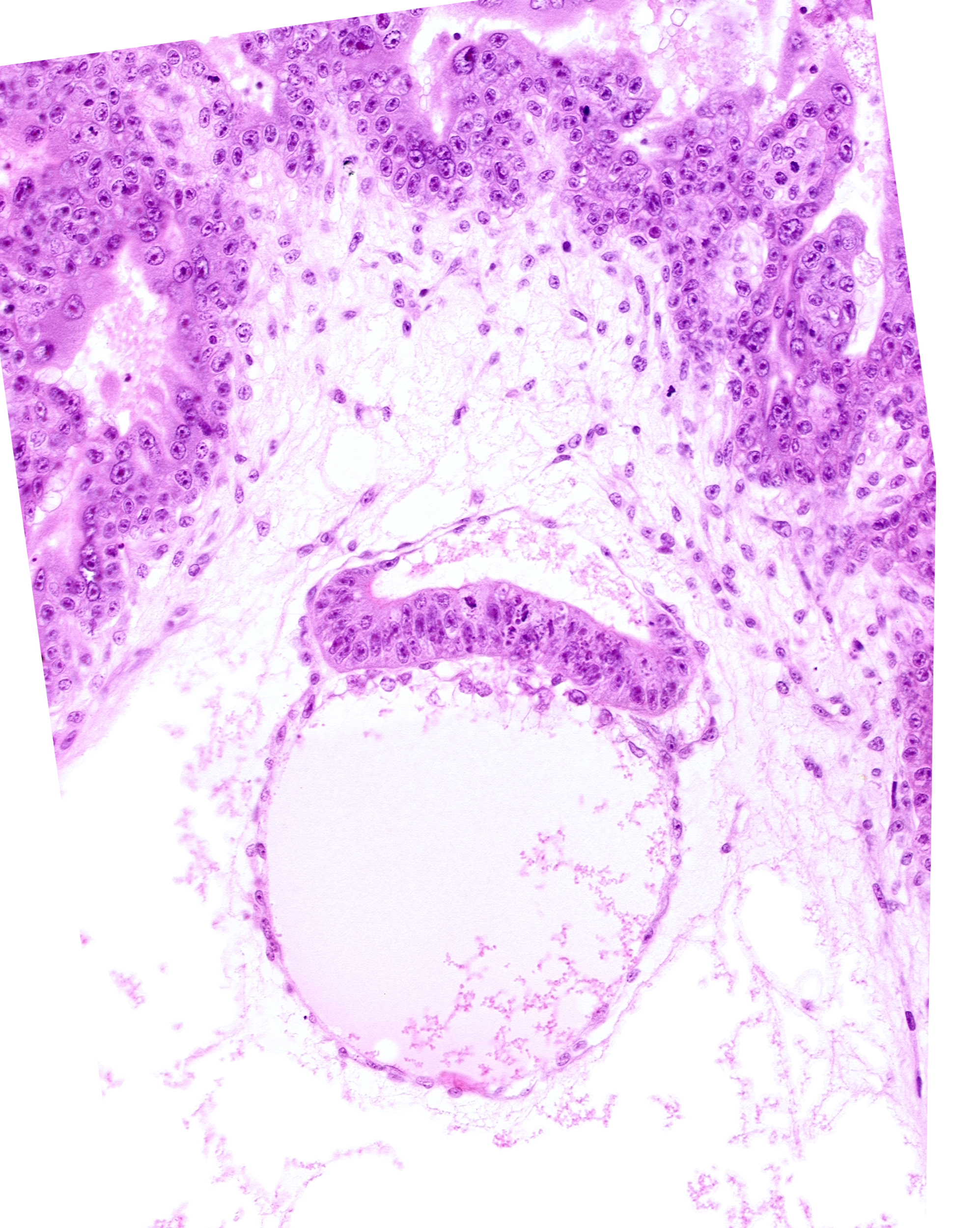 amnion, embryonic disc, extra-embryonic coelom, head mesenchyme