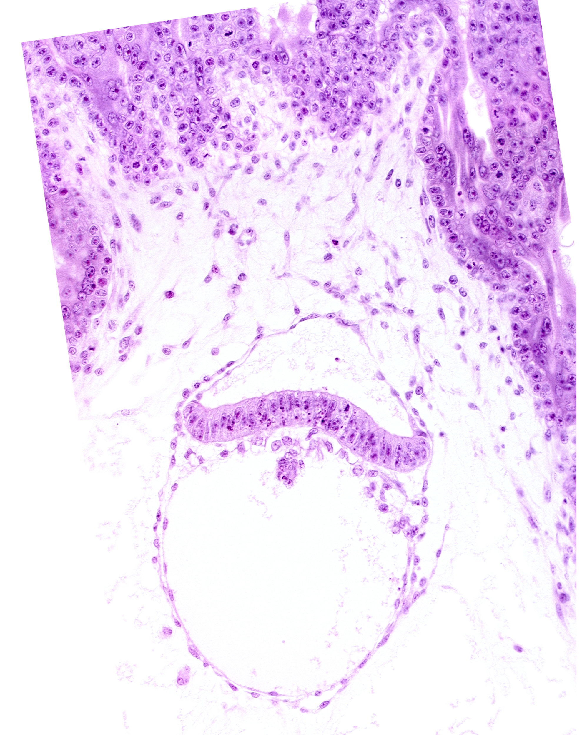 amnion, amniotic cavity, head mesenchyme, secondary umbilical vesicle cavity
