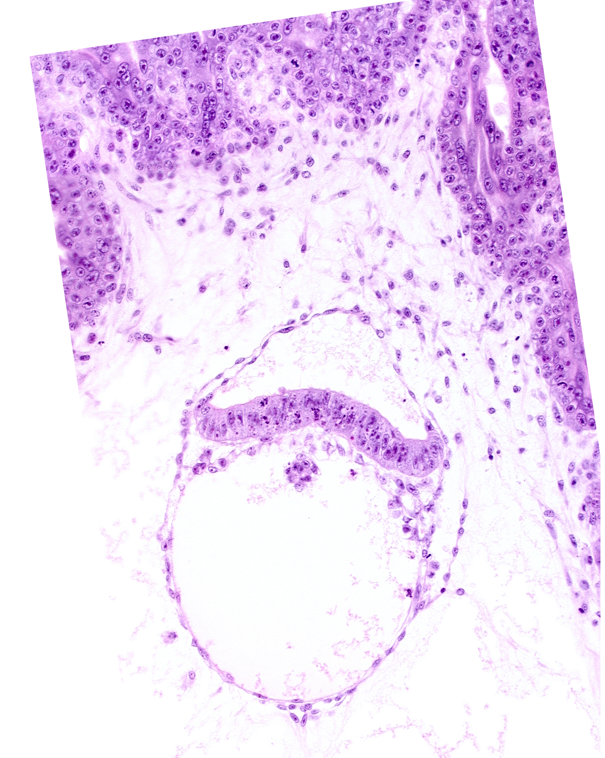 clump of cells in hypoblast, epiblast, extra-embryonic endoderm, head mesenchyme, mesoblast (mesenchyme)