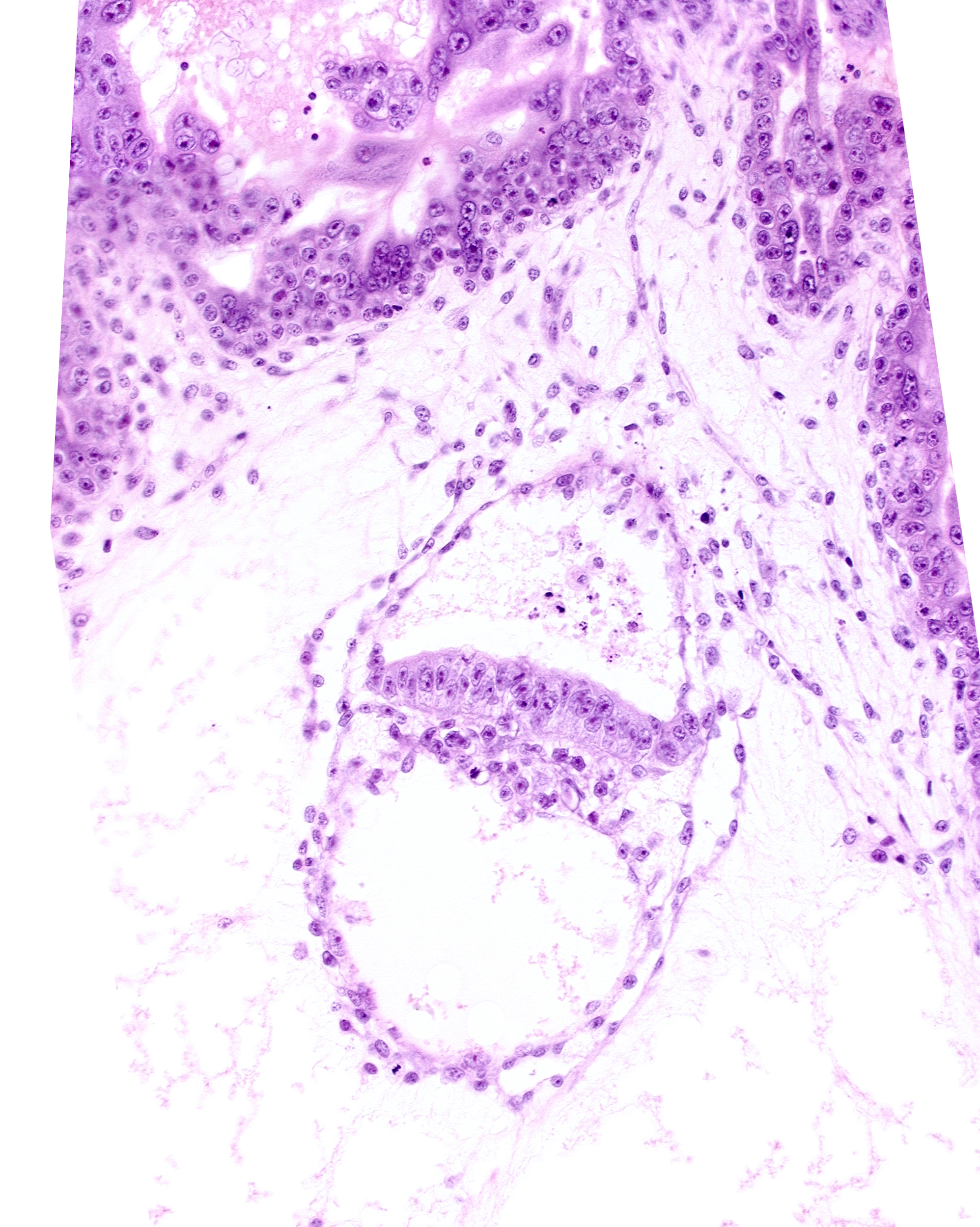amniotic cavity, epiblast, hypoblast, intervillus space(s), secondary umbilical vesicle cavity, stem villus, two-layered amnion