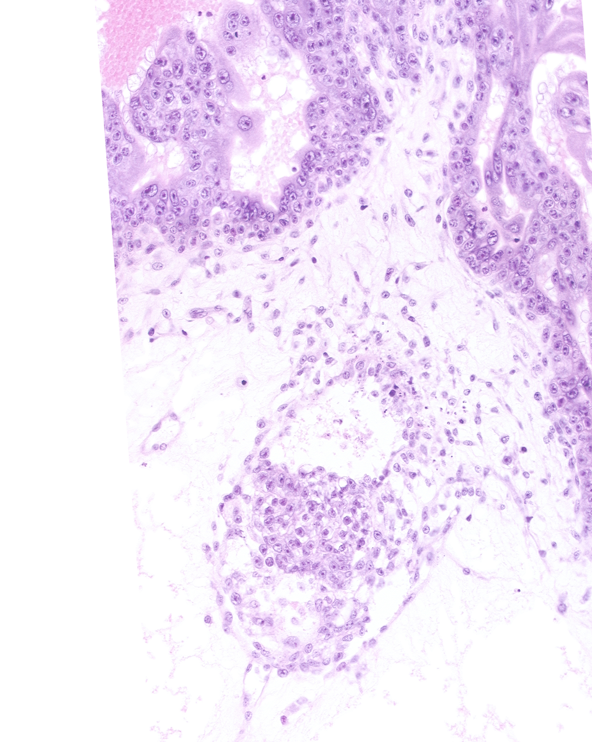 caudal edge of secondary umbilical vesicle cavity, extra-embryonic coelom, presumptive allantoic diverticulum, secondary umbilical vesicle process