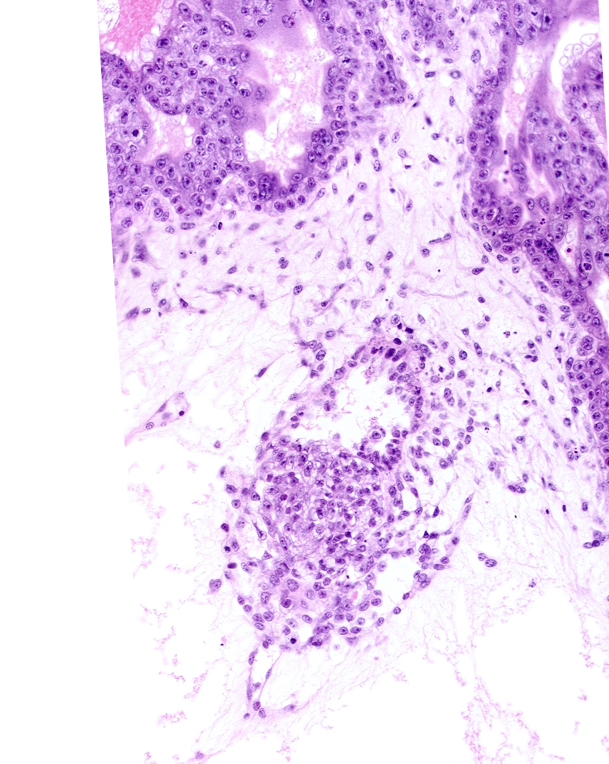 caudal part of amniotic cavity, caudal part of epiblast, endodermal mass, secondary umbilical vesicle process, specialized cells in amnion