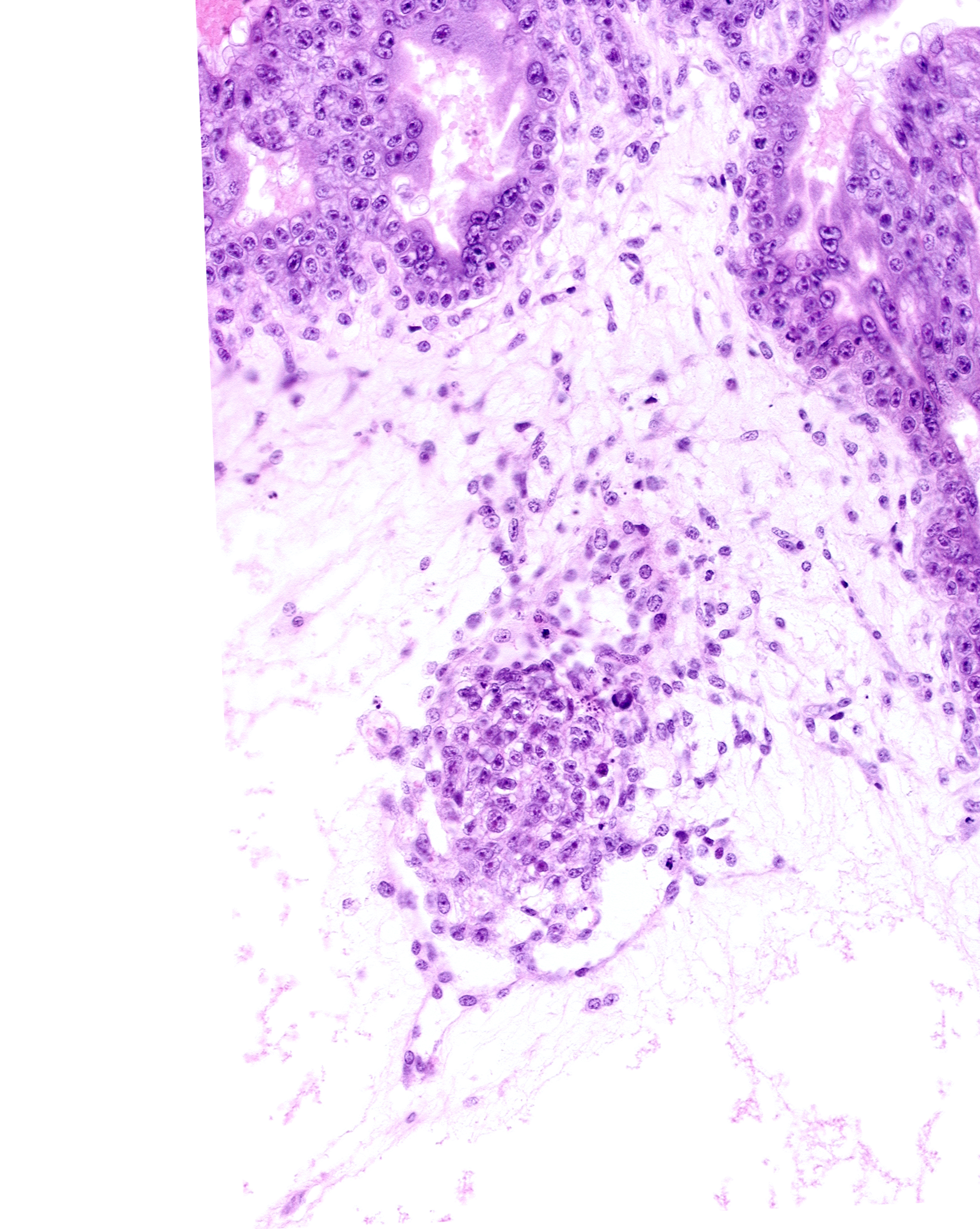 caudal edge of amniotic cavity, extra-embryonic coelom, primordial blood vessel(s)