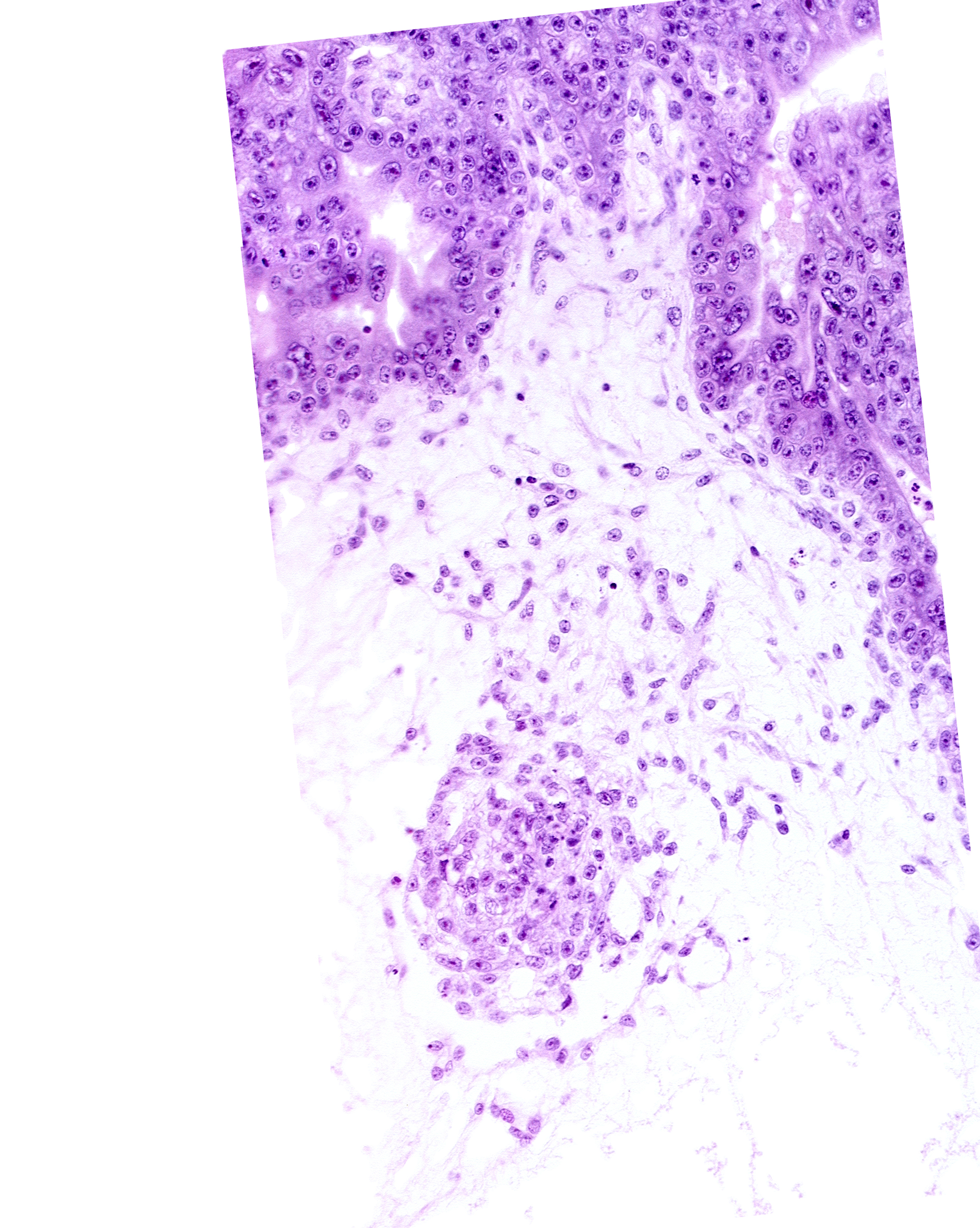 extra-embryonic coelom, primordial blood vessel(s), stem villus, syncytiotrophoblast