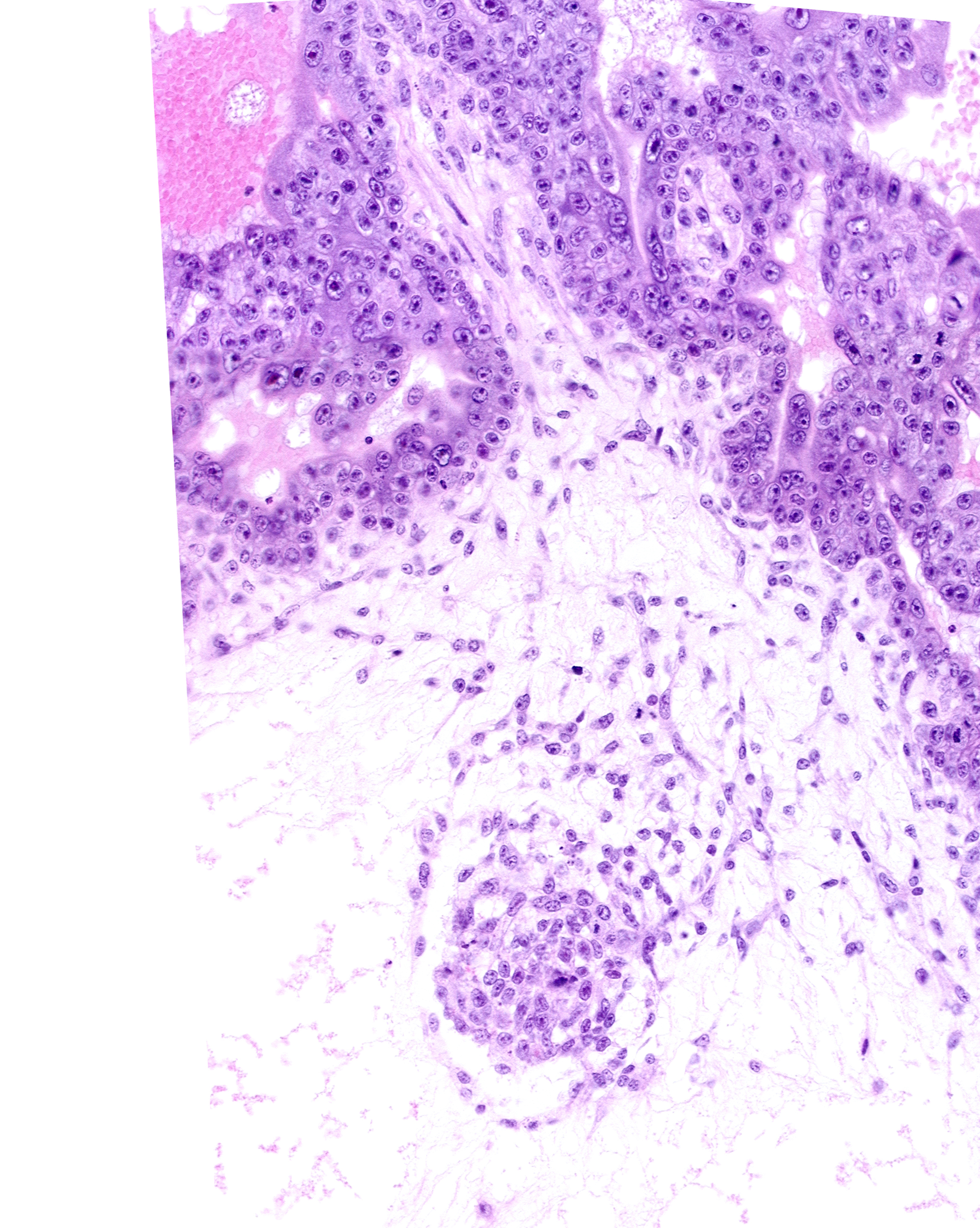 endodermal mass, extra-embryonic mesoblast, hemangioblastic tissue, primordial connecting stalk mesenchyme, stem villus