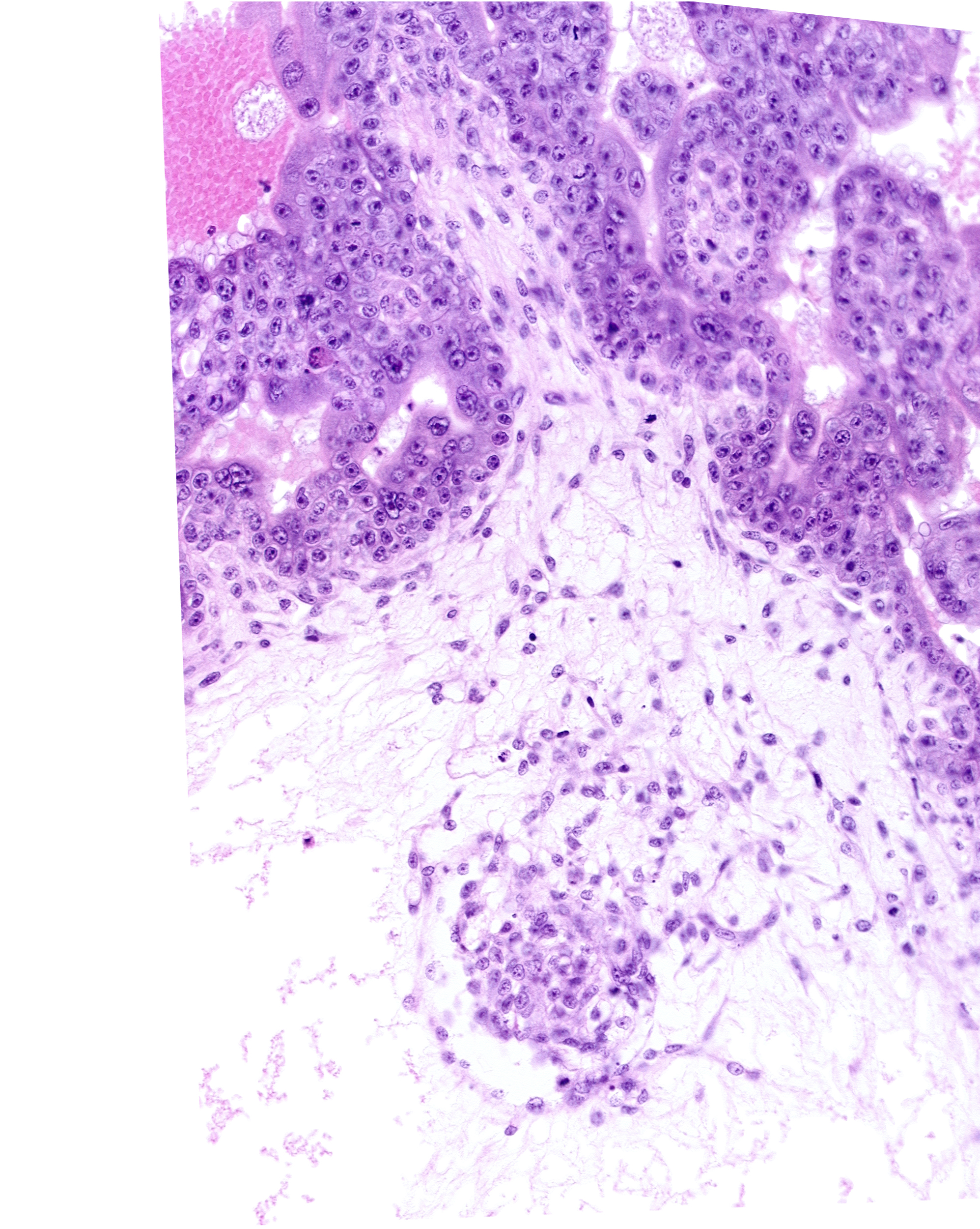 extra-embryonic coelom, extra-embryonic mesoblast, intervillus space(s)