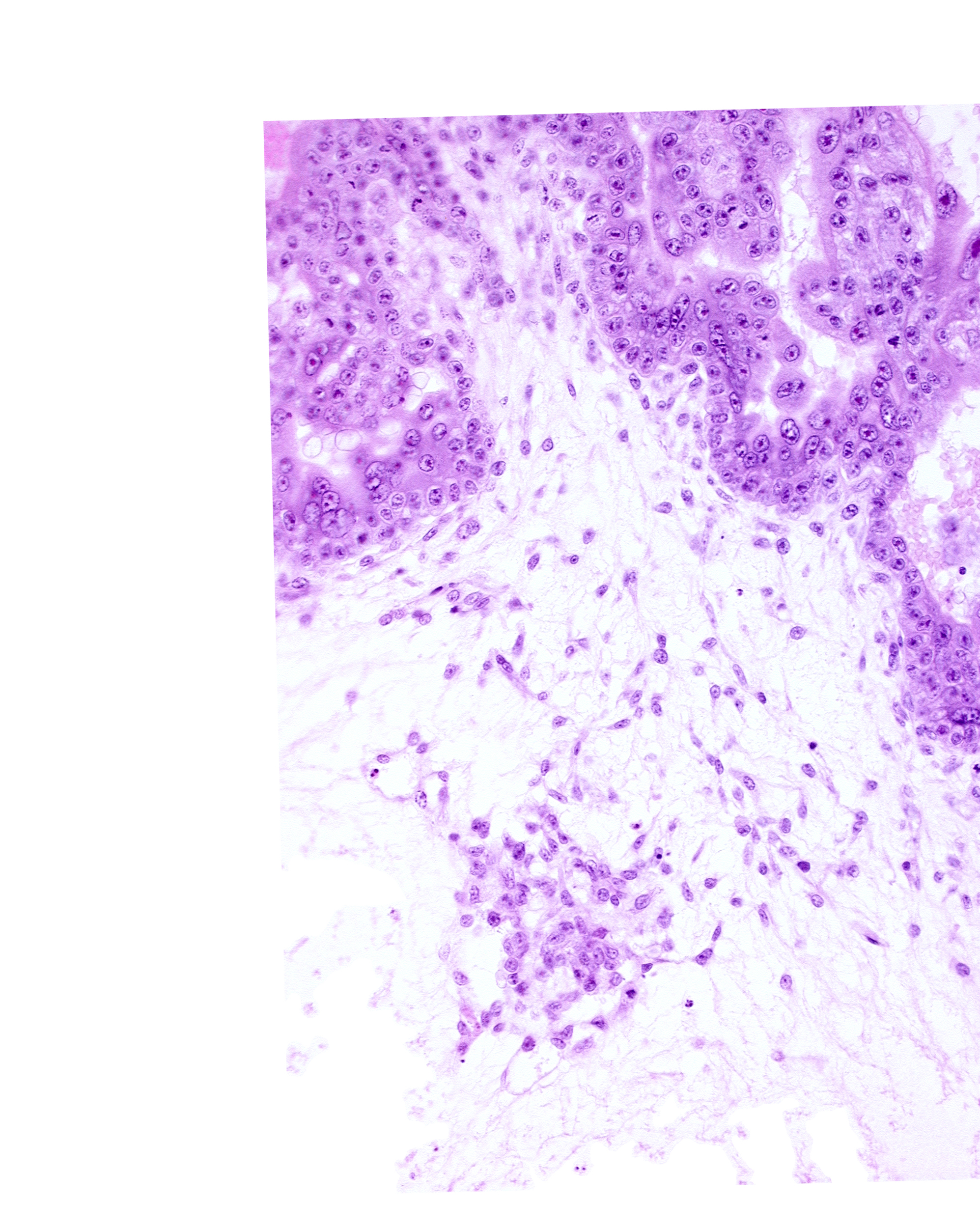caudal edge of endodermal mass, cytotrophoblast, extra-embryonic coelom, intervillus space(s), syncytiotrophoblast