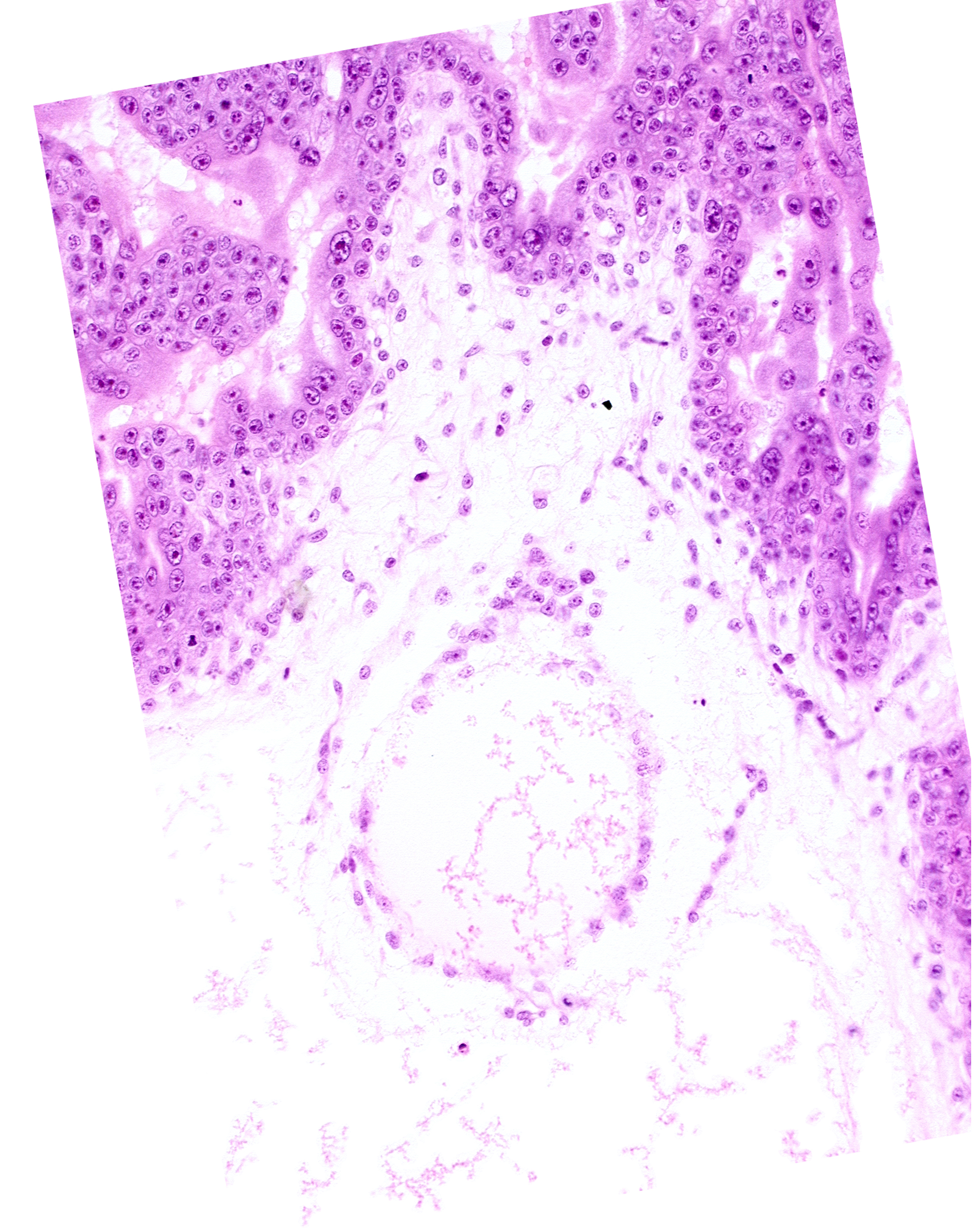 cephalic edge of embryonic disc, extra-embryonic coelom, extra-embryonic somatopleuric mesoderm, mesoblast (mesenchyme), secondary umbilical vesicle cavity, secondary umbilical vesicle wall, stem villus