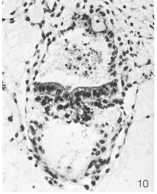 Embryonic disc