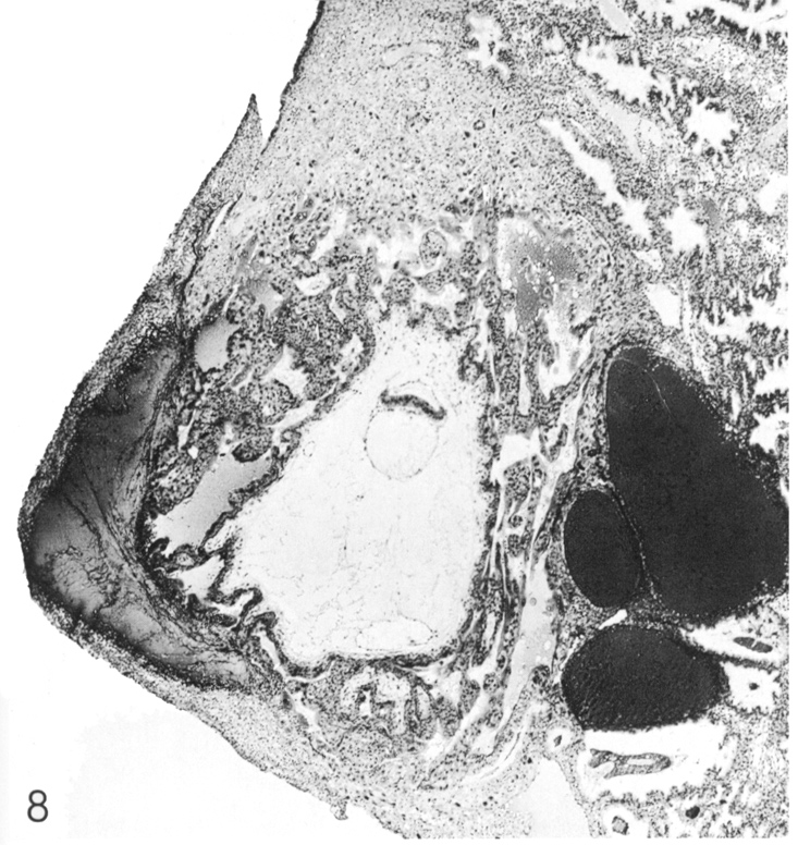 Tissues at and near the implantation site