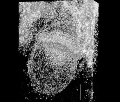 Embryo