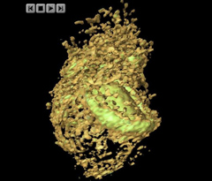 Embryonic Disc and Fetal Membranes
