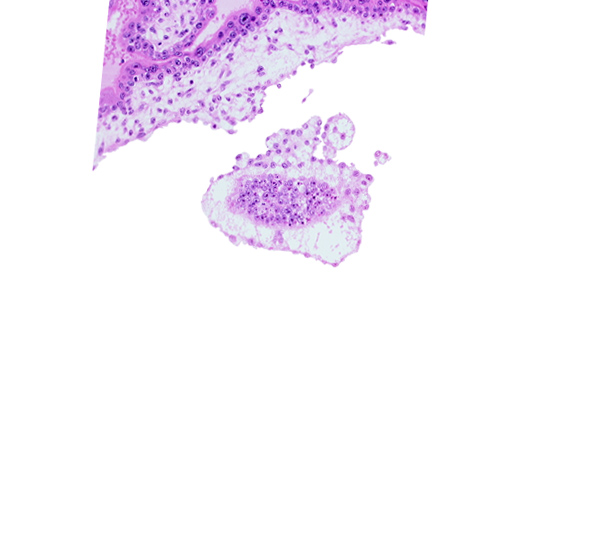 cephalic part of embryonic disc, chorionic cavity