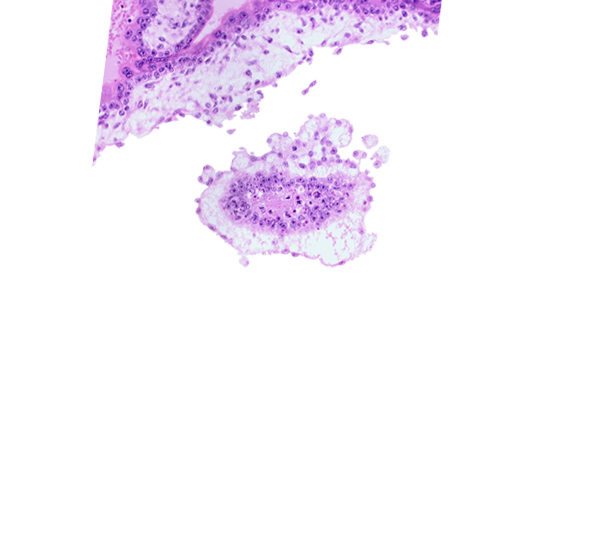 cephalic part of embryonic disc, chorionic cavity